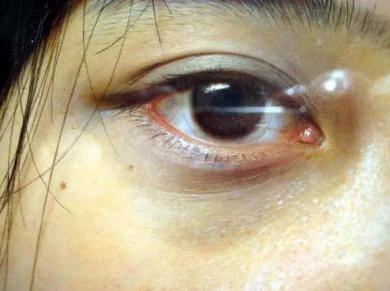 冷軍：極端寫實主義