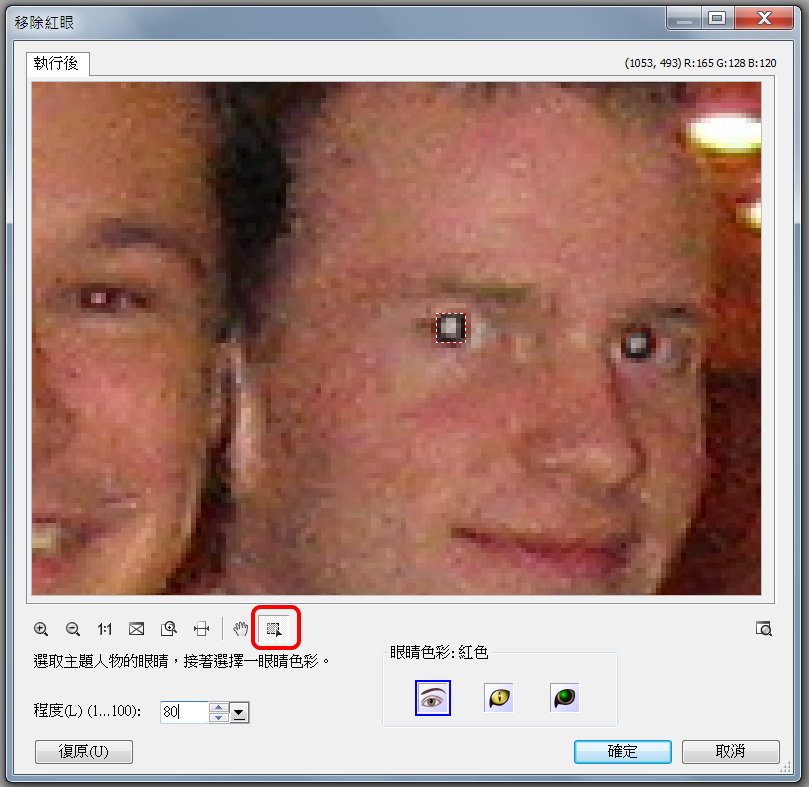 移除紅眼
